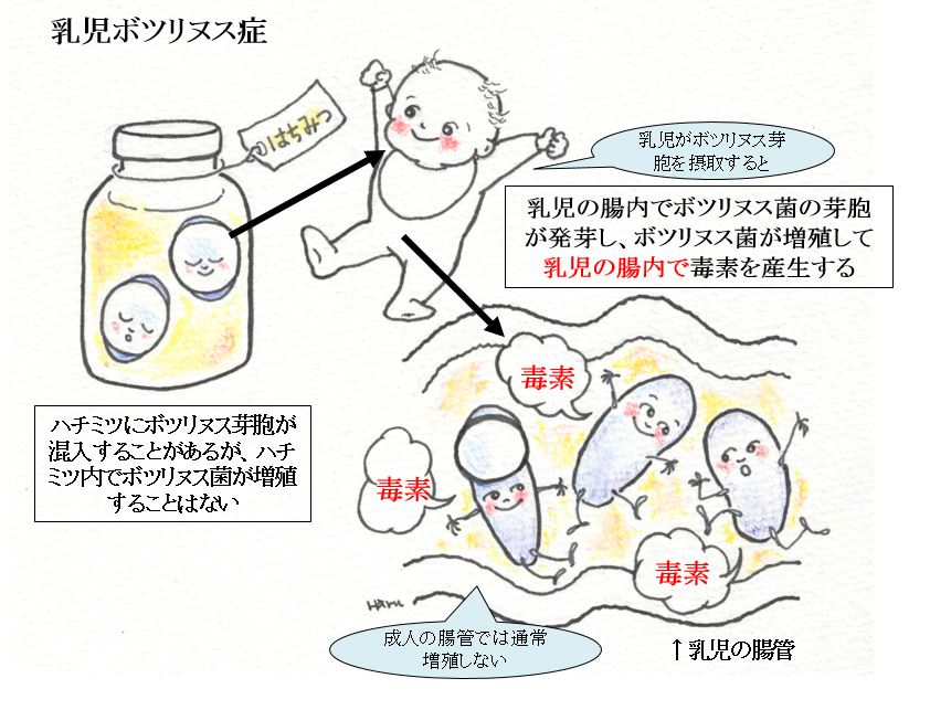 ボツリヌス症とは